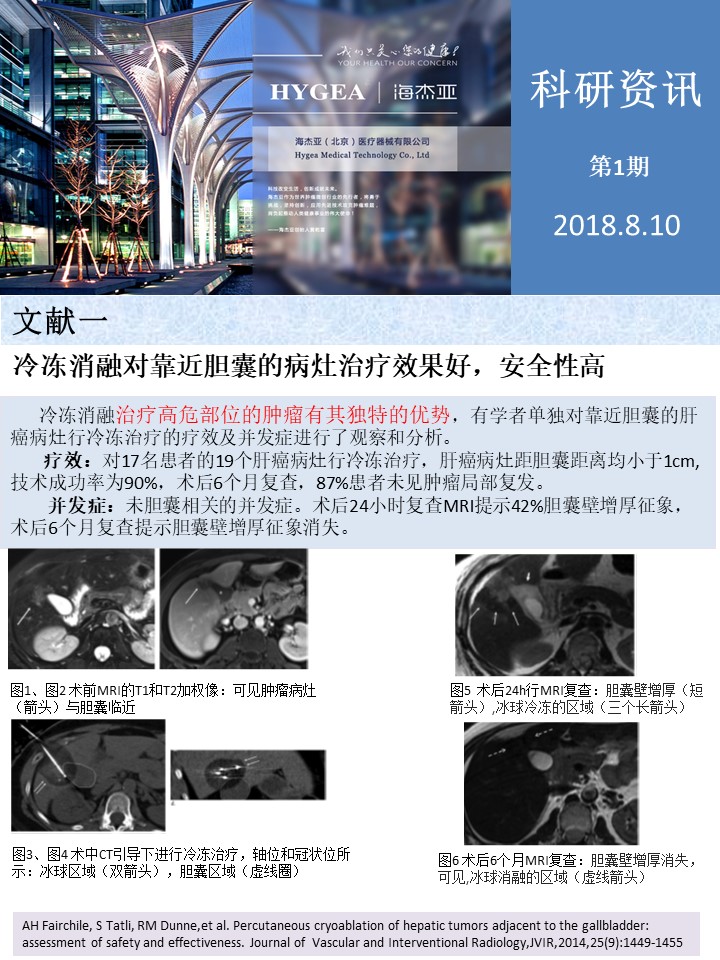 【海杰亞科研資訊】第1期——肝、肺癌消融
